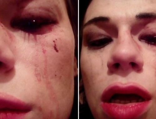 Outspoken Trans Activist Violently Asaulted In Georgia’s Capital, Tbilisi